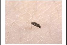 Tiny Flying Bugs In Bedroom That Bite